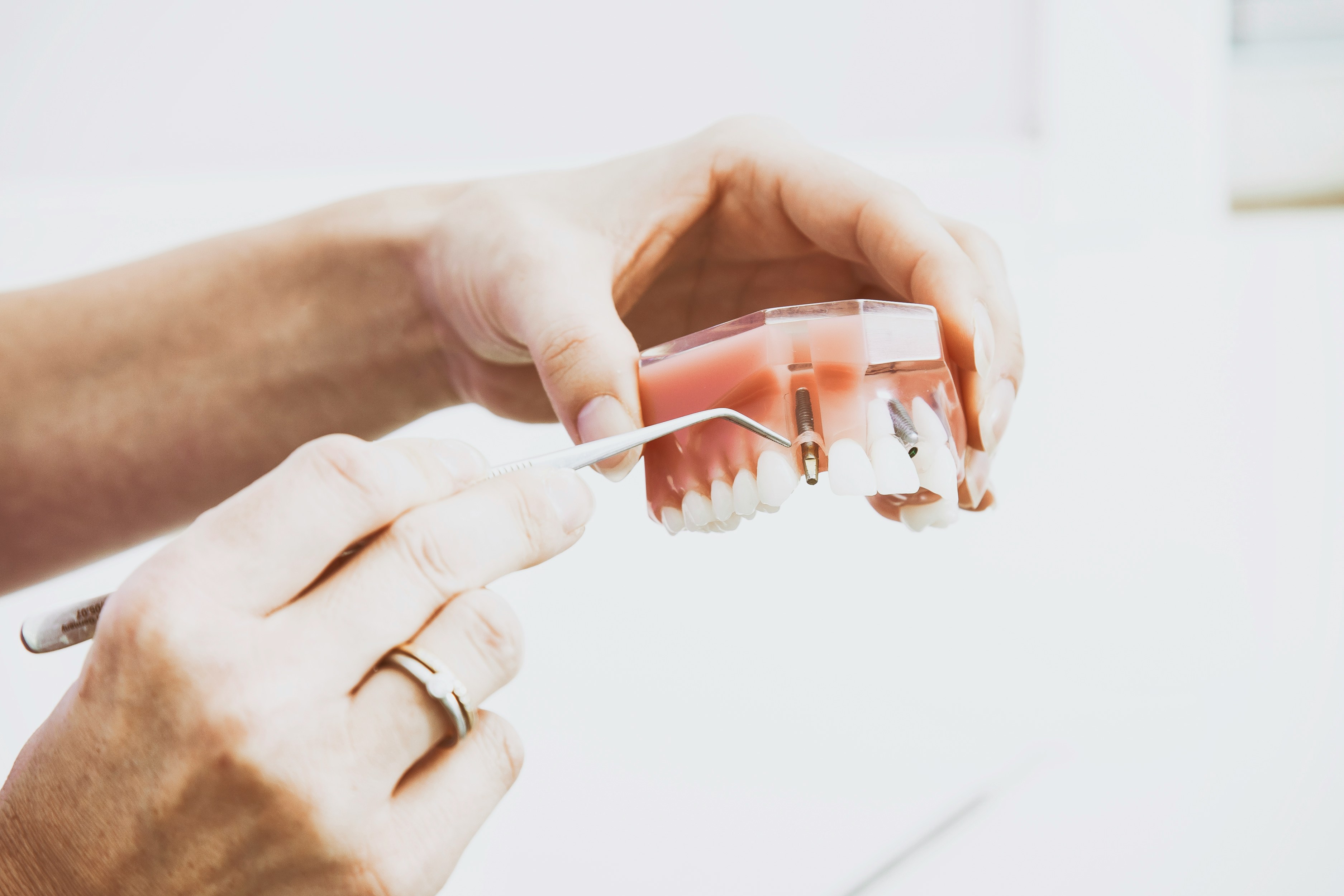 Implantes Dentários New Clinic